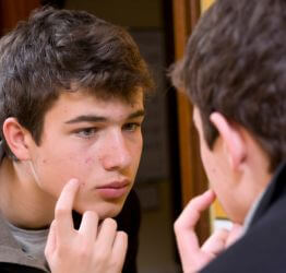 Boy with acne looking in the mirror